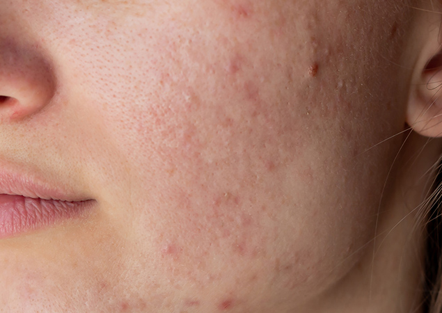 transformation-img-1 transformation-img-1